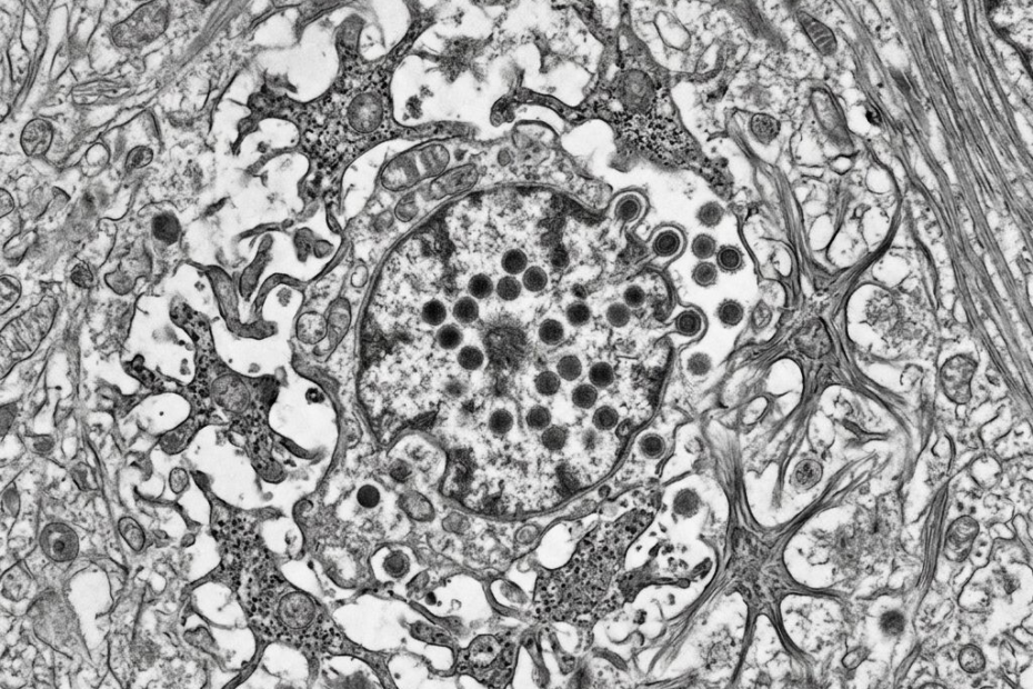 A Common Virus May Cause Brain Immune Cells to Change Their Priorities