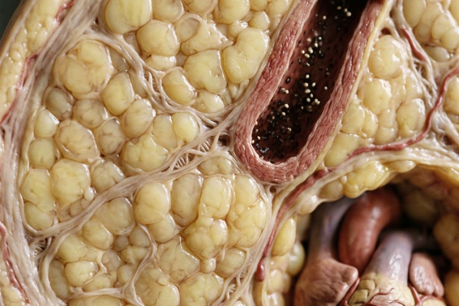 Obesity Is More Than a Number: 127 Genetic Clues Point Beyond BMI