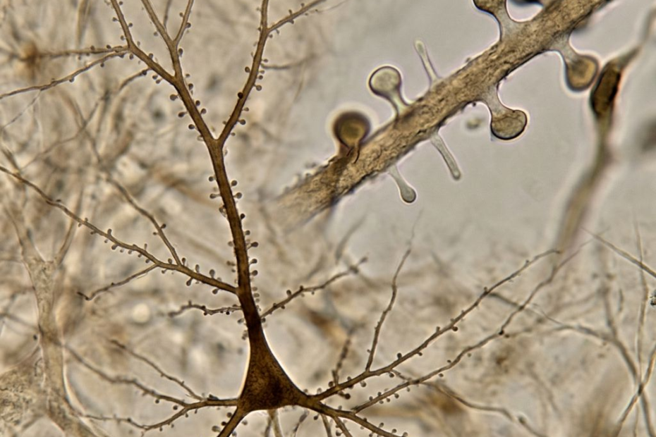 Psilocybin Rewires the Mouse Brain—and Scientists Have Separated That Change from a Signal Linked to Hallucinations